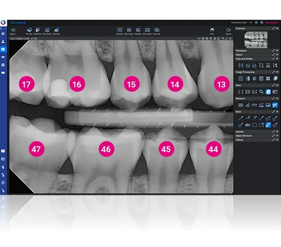 planmeca-prosensor-hd-effortless-workflow.jpg