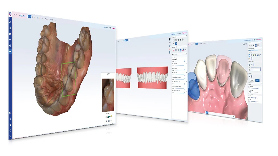 planmeca-romexis-cadcam-carousel.jpg