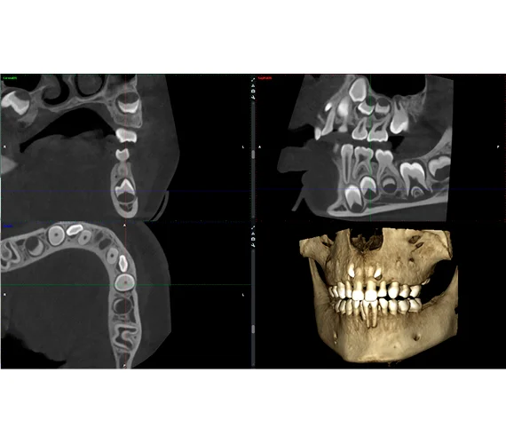 planmeca-viso-g3-clinical-images.jpg