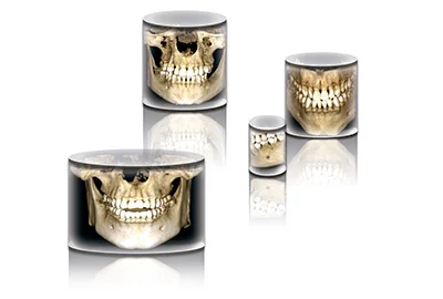 Planmeca ProMax 3D Plus volumes