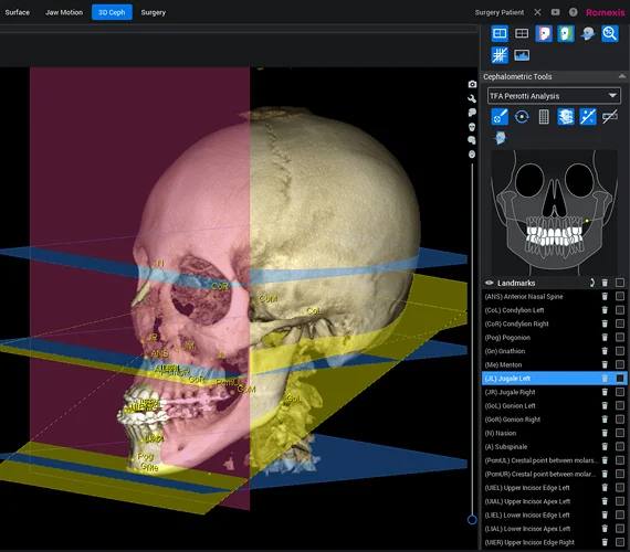 True 3D Analysis