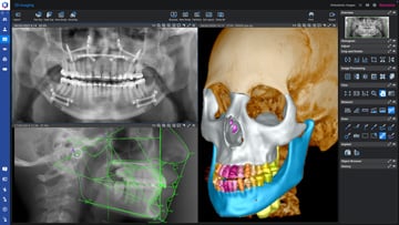 romexis-ortho.jpg