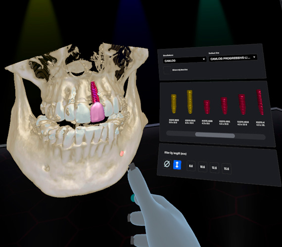 romexis-vr-implant-treatment.jpg
