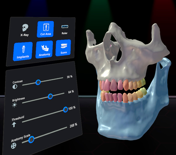 romexis-vr-view-and-visualize-3d-data.jpg