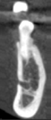 Imaging ultra low dose mode voxel size 600