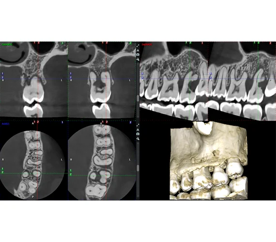 planmeca-viso-g7-endodontic-imaging.jpg