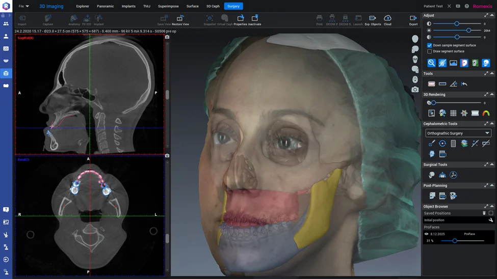 romexis-cmf-surgery.jpg